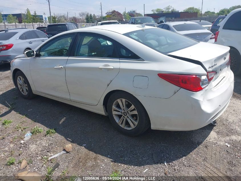 2011 Hyundai Sonata Gls VIN: 5NPEB4AC7BH215347 Lot: 12005636