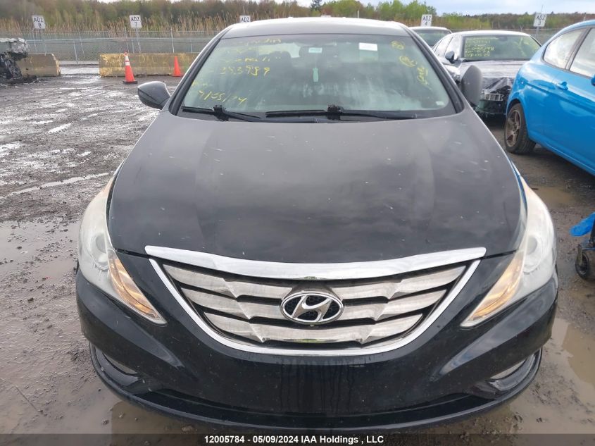 2011 Hyundai Sonata Gls VIN: 5NPEB4AC2BH283989 Lot: 12005784