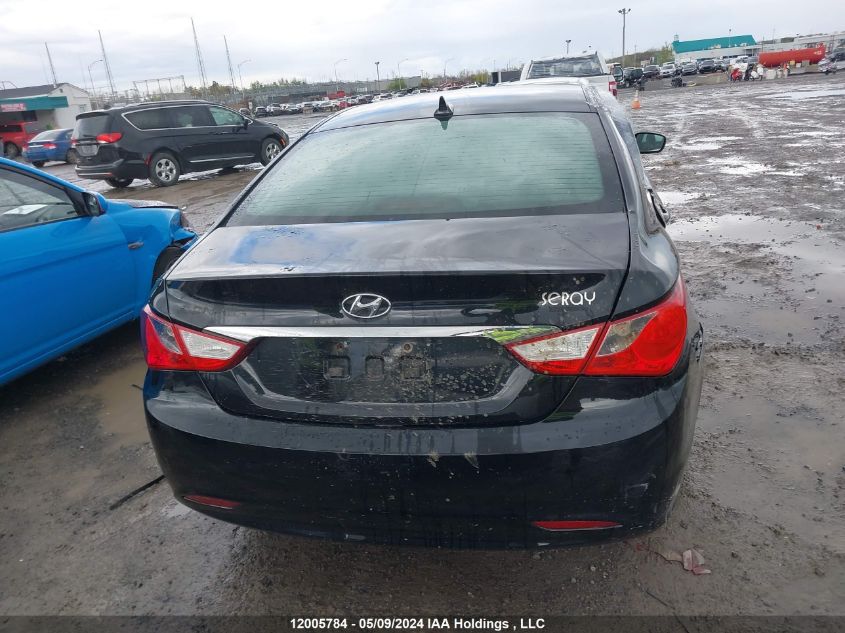 2011 Hyundai Sonata Gls VIN: 5NPEB4AC2BH283989 Lot: 12005784