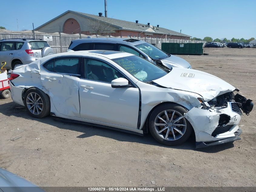 2018 Acura Tlx VIN: 19UUB1F53JA801359 Lot: 12006079