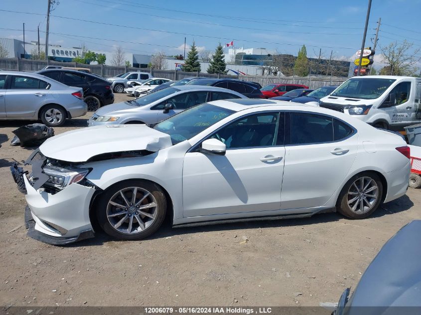 2018 Acura Tlx VIN: 19UUB1F53JA801359 Lot: 12006079