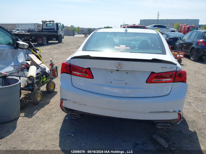 2018 Acura Tlx VIN: 19UUB1F53JA801359 Lot: 12006079