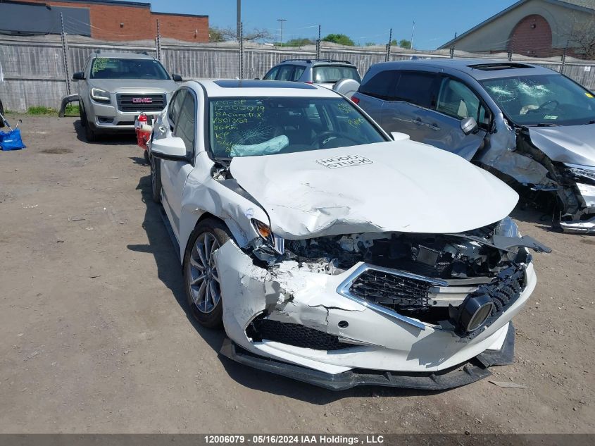 2018 Acura Tlx VIN: 19UUB1F53JA801359 Lot: 12006079