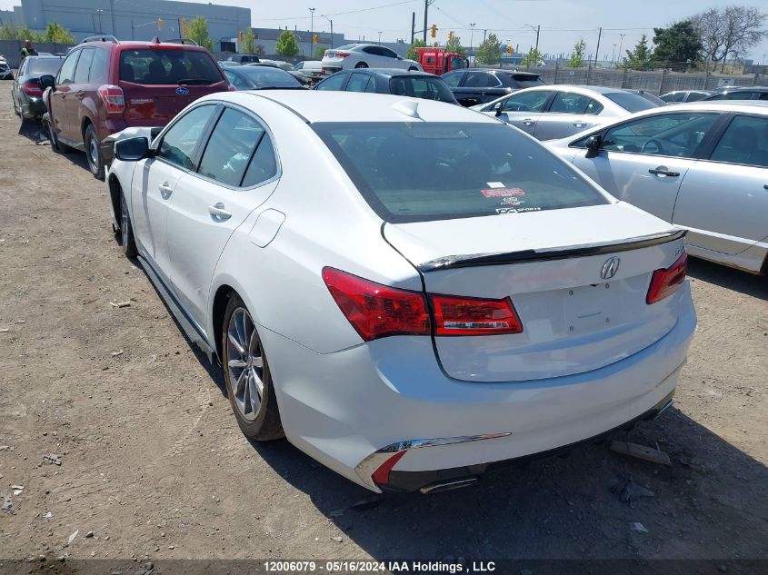 2018 Acura Tlx VIN: 19UUB1F53JA801359 Lot: 12006079