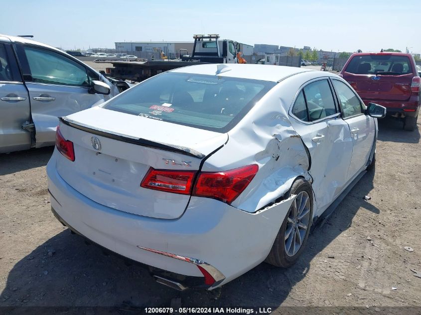 2018 Acura Tlx VIN: 19UUB1F53JA801359 Lot: 12006079