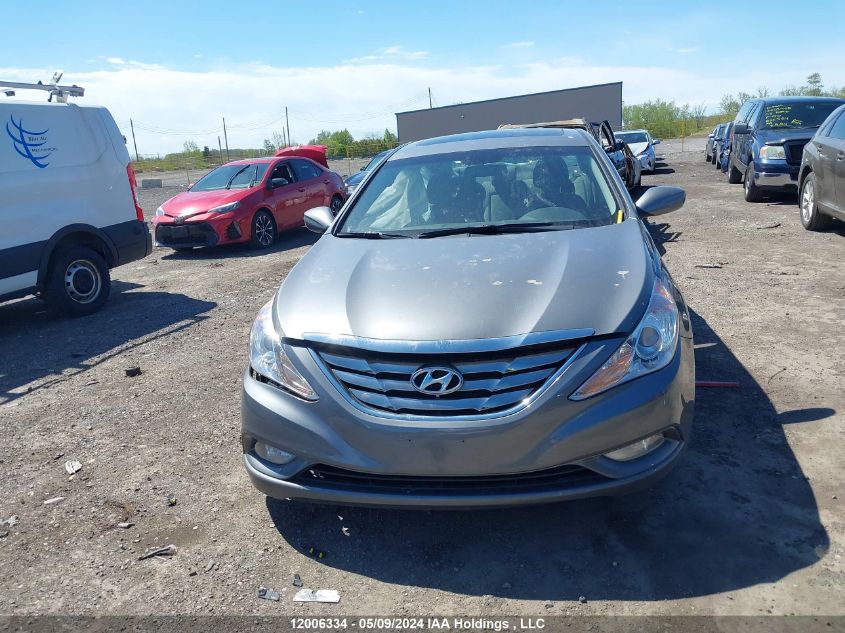 2013 Hyundai Sonata Gls VIN: 5NPEB4AC3DH689539 Lot: 12006334