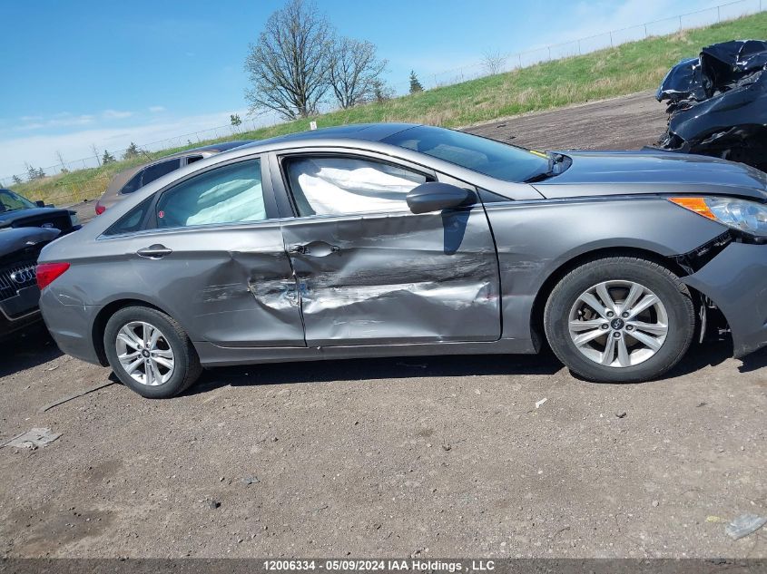 2013 Hyundai Sonata Gls VIN: 5NPEB4AC3DH689539 Lot: 12006334