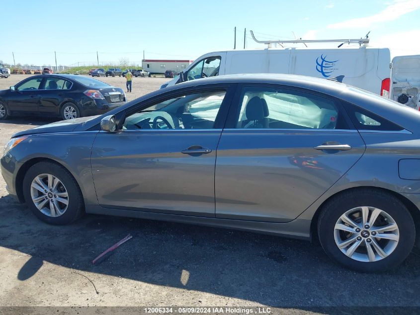 2013 Hyundai Sonata Gls VIN: 5NPEB4AC3DH689539 Lot: 12006334