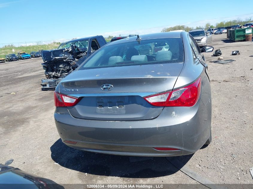 2013 Hyundai Sonata Gls VIN: 5NPEB4AC3DH689539 Lot: 12006334