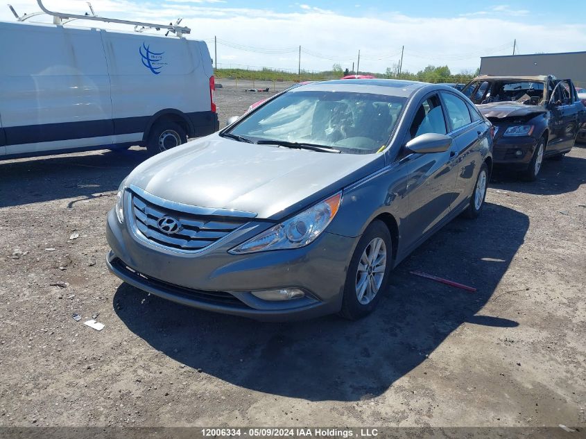 2013 Hyundai Sonata Gls VIN: 5NPEB4AC3DH689539 Lot: 12006334