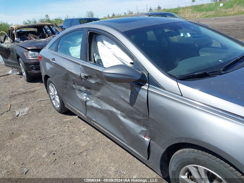 2013 Hyundai Sonata Gls VIN: 5NPEB4AC3DH689539 Lot: 12006334