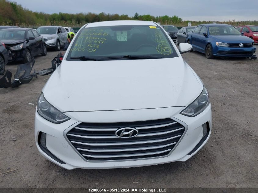 2017 Hyundai Elantra Gl VIN: KMHD84LF9HU372454 Lot: 12006616