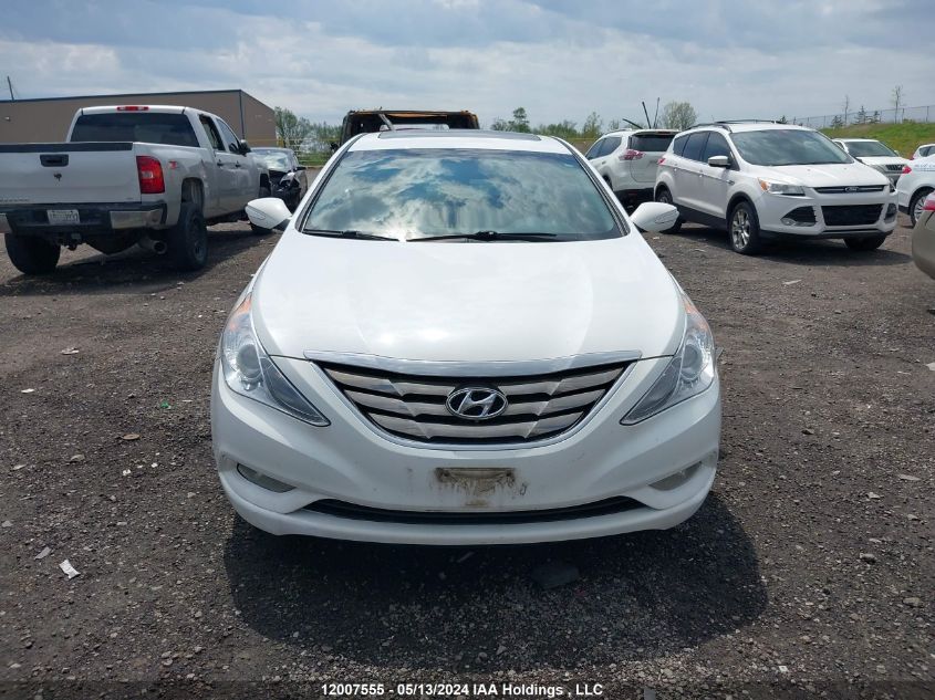 2013 Hyundai Sonata Se/Limited VIN: 5NPEC4ACXDH546746 Lot: 12007555