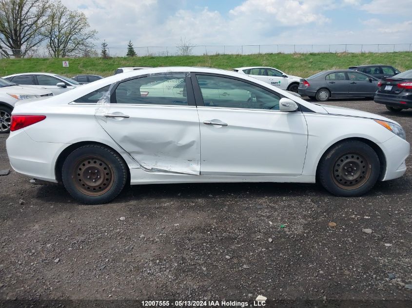 2013 Hyundai Sonata Se/Limited VIN: 5NPEC4ACXDH546746 Lot: 12007555