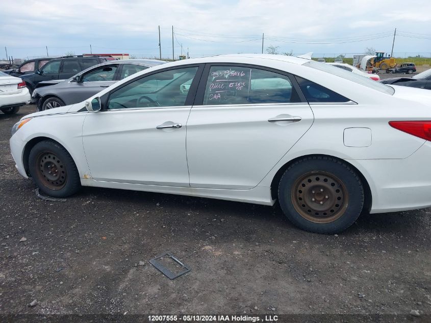 2013 Hyundai Sonata Se/Limited VIN: 5NPEC4ACXDH546746 Lot: 12007555