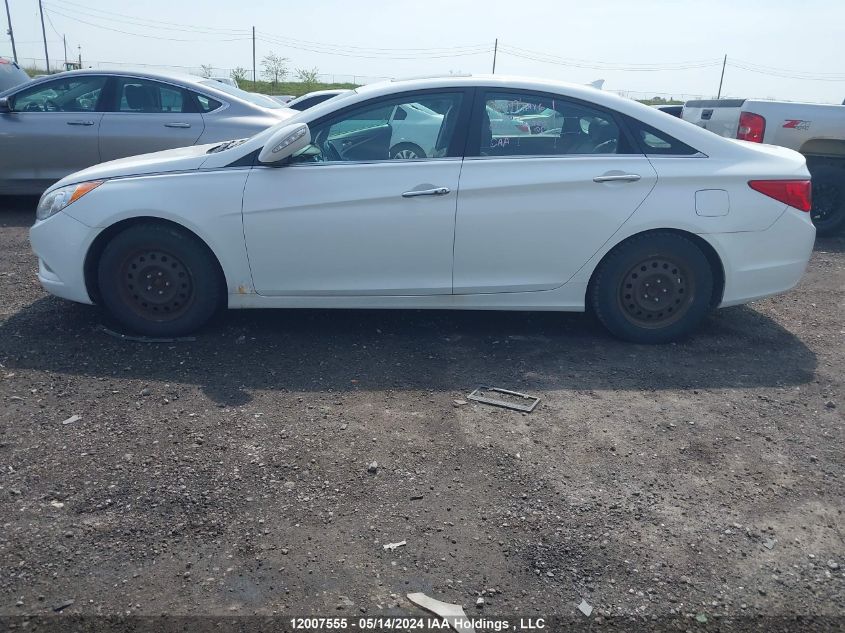 2013 Hyundai Sonata Se/Limited VIN: 5NPEC4ACXDH546746 Lot: 12007555