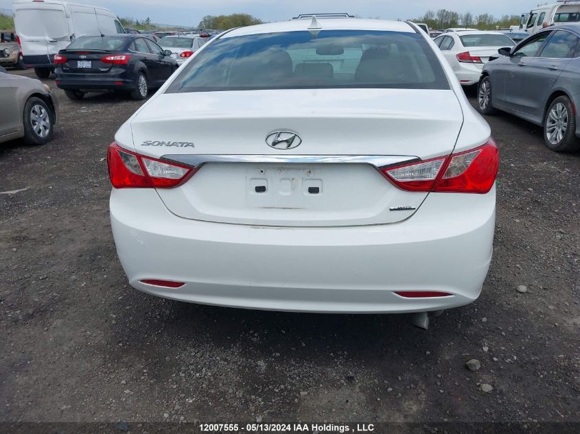 2013 Hyundai Sonata Se/Limited VIN: 5NPEC4ACXDH546746 Lot: 12007555