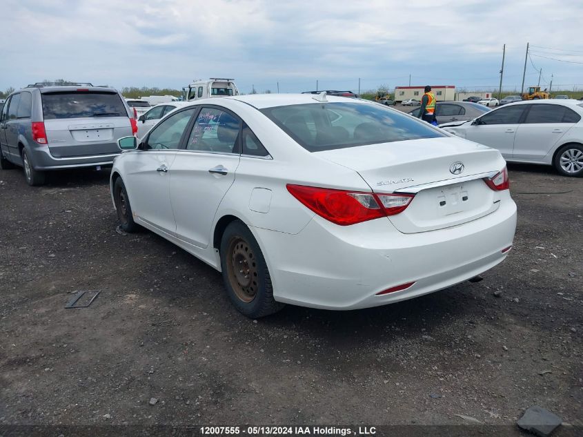 2013 Hyundai Sonata Se/Limited VIN: 5NPEC4ACXDH546746 Lot: 12007555