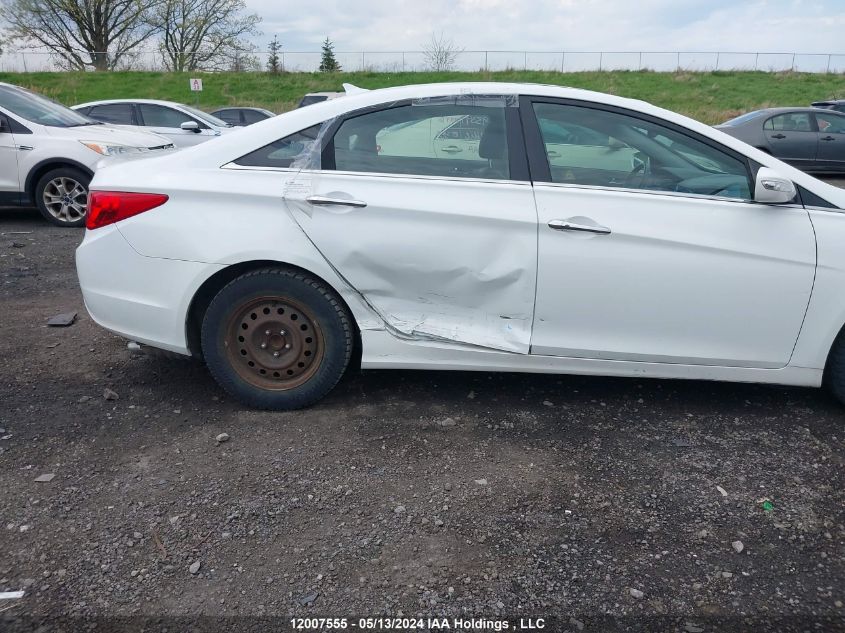 2013 Hyundai Sonata Se/Limited VIN: 5NPEC4ACXDH546746 Lot: 12007555