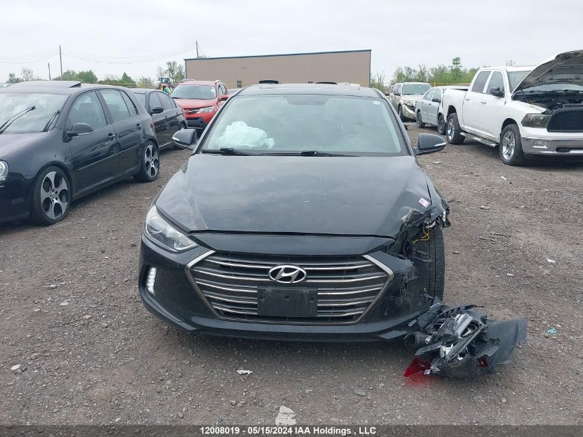 2017 Hyundai Elantra Limited VIN: KMHD84LF0HU086153 Lot: 12008019