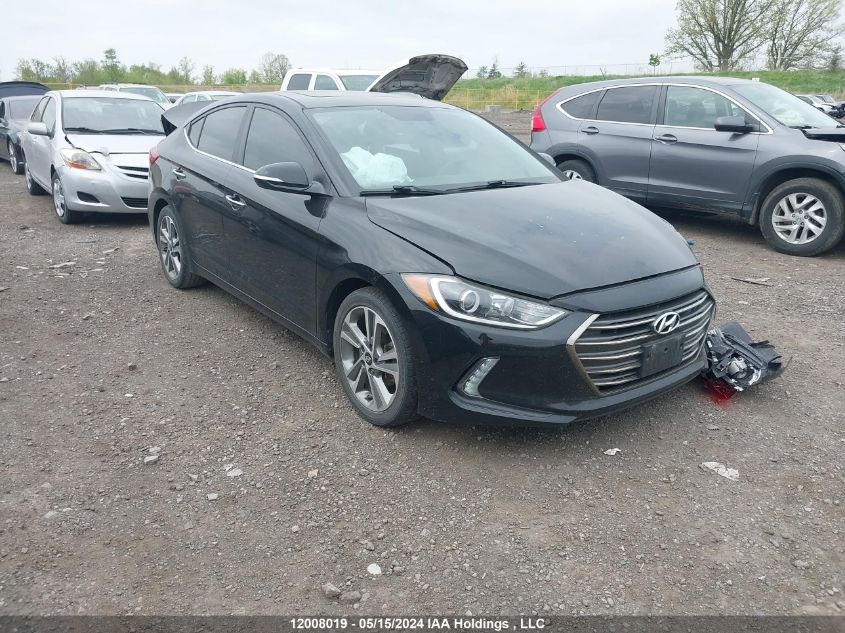 2017 Hyundai Elantra Limited VIN: KMHD84LF0HU086153 Lot: 12008019