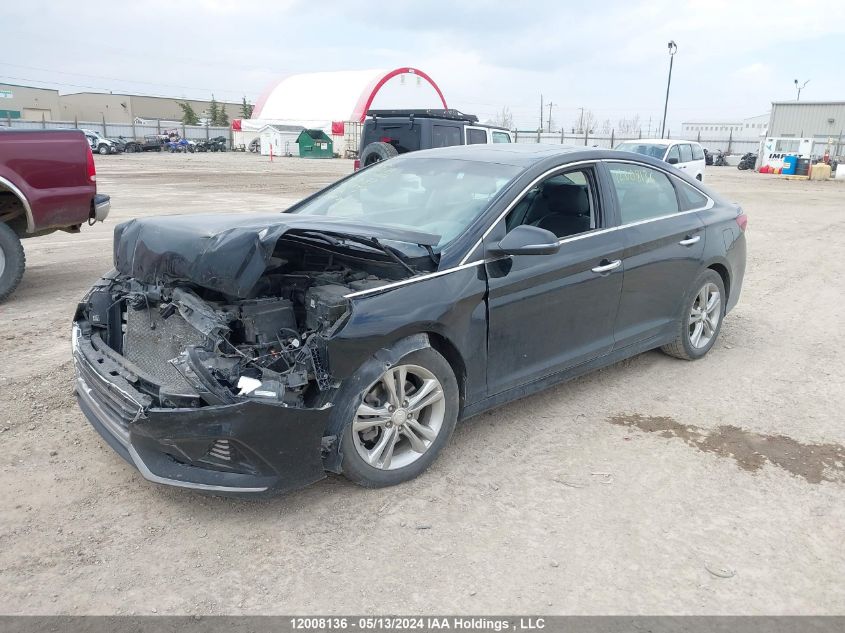 2018 Hyundai Sonata Sport/Limited/Sel VIN: 5NPE34AF8JH609087 Lot: 12008136