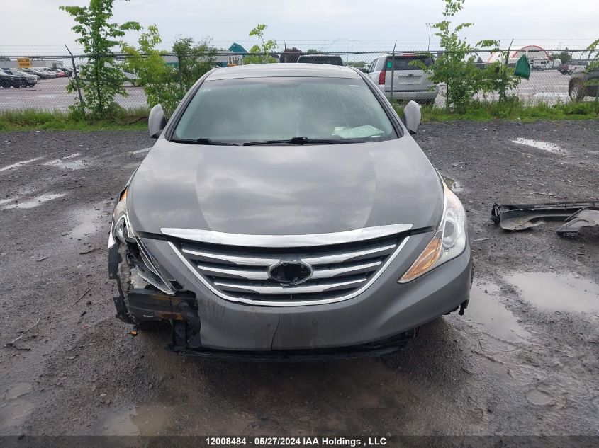 2014 Hyundai Sonata Gls VIN: 5NPEB4AC9EH832592 Lot: 12008484