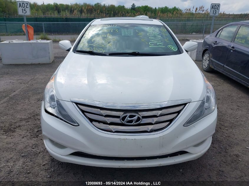 2013 Hyundai Sonata Gls VIN: 5NPEB4AC6DH719357 Lot: 12008693
