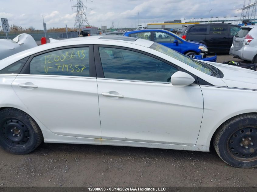 2013 Hyundai Sonata Gls VIN: 5NPEB4AC6DH719357 Lot: 12008693