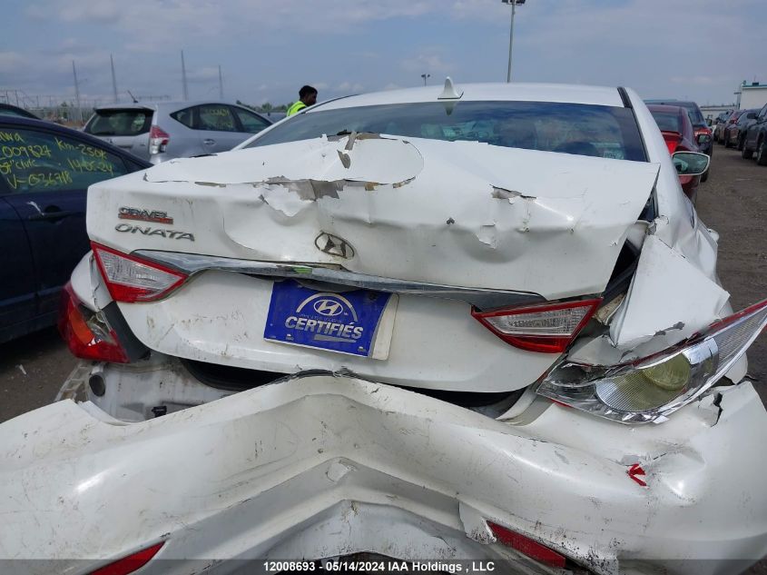 2013 Hyundai Sonata Gls VIN: 5NPEB4AC6DH719357 Lot: 12008693