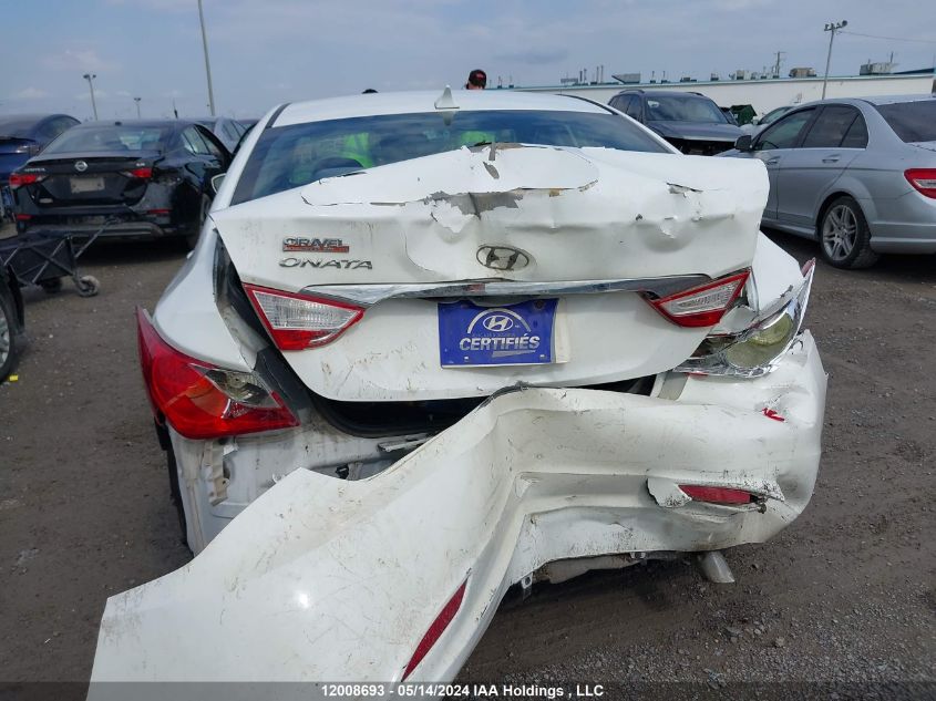 2013 Hyundai Sonata Gls VIN: 5NPEB4AC6DH719357 Lot: 12008693