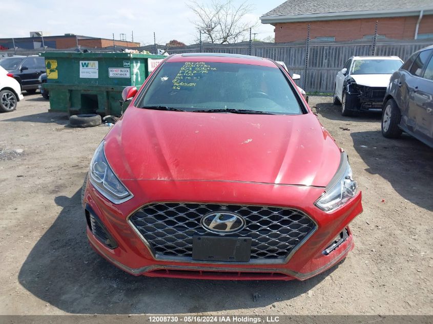 2018 Hyundai Sonata VIN: 5NPE34AF2JH722095 Lot: 12008730