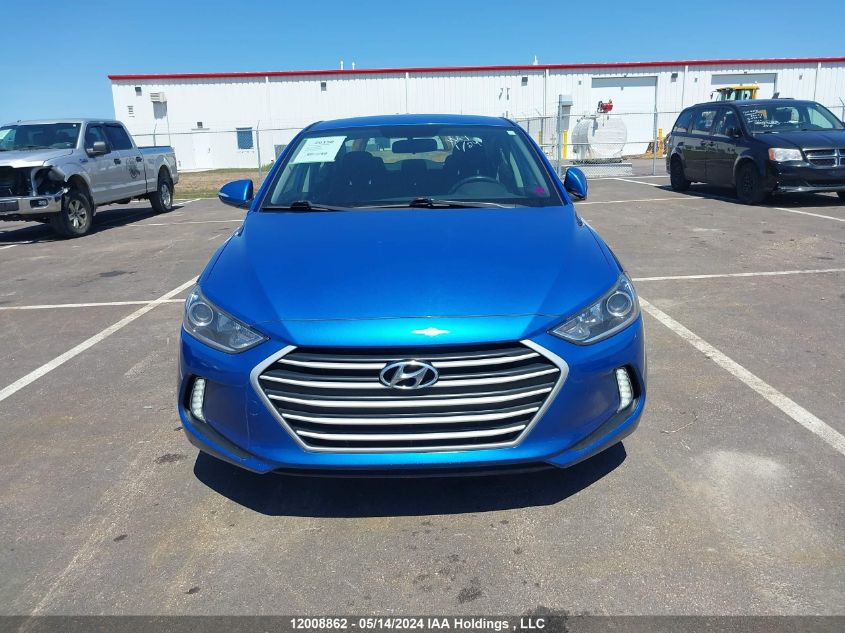 2017 Hyundai Elantra Gl VIN: KMHD84LF6HU132861 Lot: 12008862