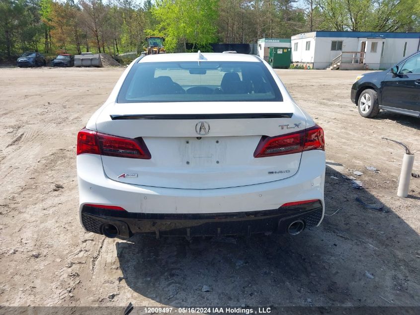 2019 Acura Tlx Advance VIN: 19UUB3F84KA800308 Lot: 12009497