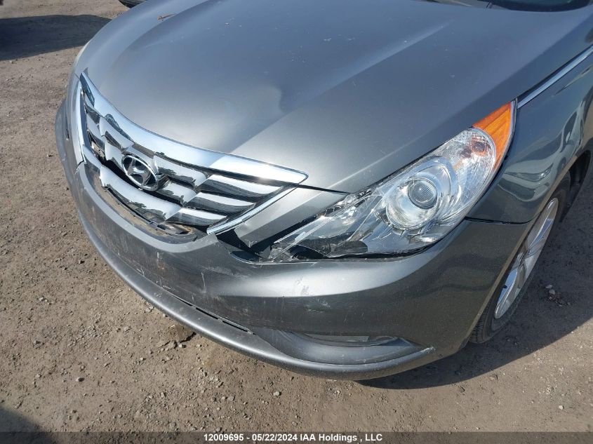 2013 Hyundai Sonata Gls VIN: 5NPEB4AC5DH792154 Lot: 12009695