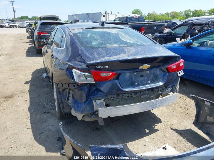 2017 Chevrolet Malibu VIN: 1G1ZE5ST2HF113933 Lot: 12010819