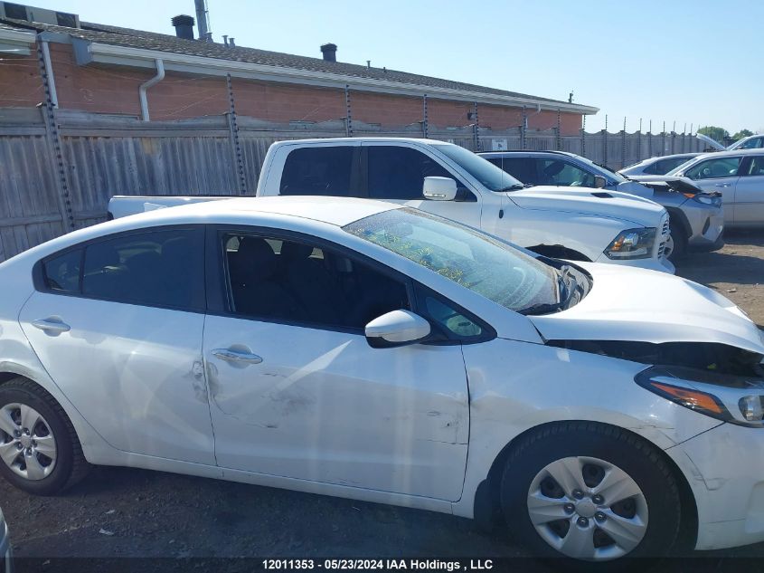 2017 Kia Forte VIN: 3KPFL4A71HE135186 Lot: 12011353