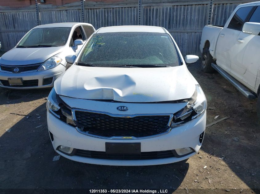 2017 Kia Forte VIN: 3KPFL4A71HE135186 Lot: 12011353