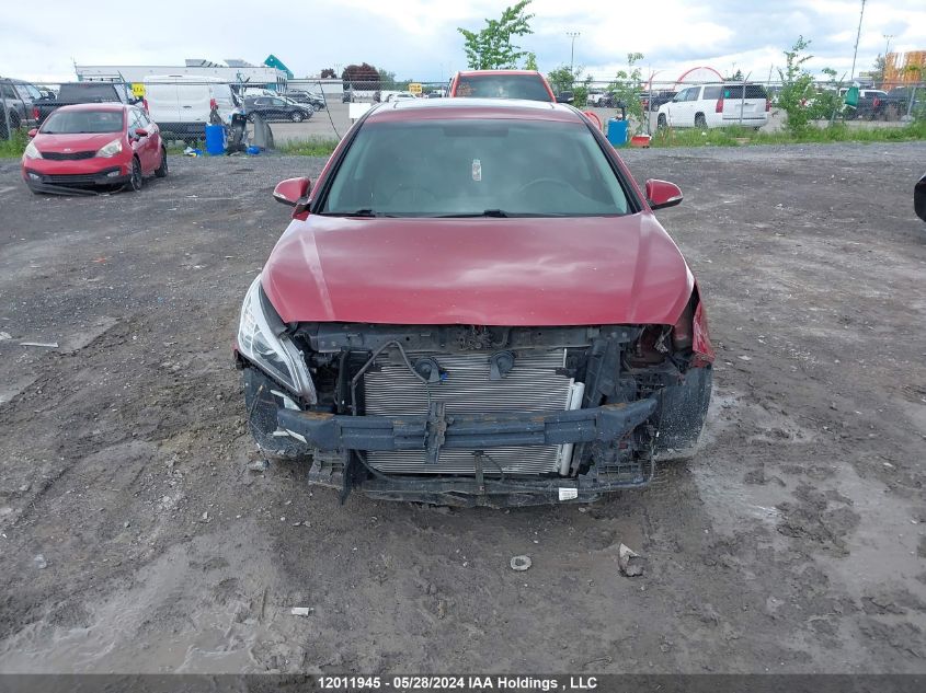 2016 Hyundai Sonata Gls Special Edition VIN: 5NPE24AFXGH323690 Lot: 12011945