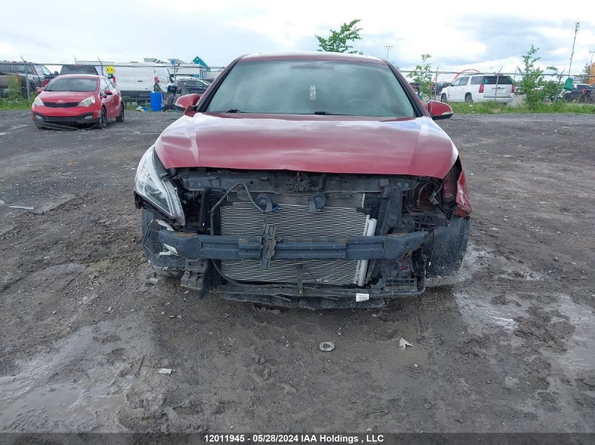 2016 Hyundai Sonata Gls Special Edition VIN: 5NPE24AFXGH323690 Lot: 12011945