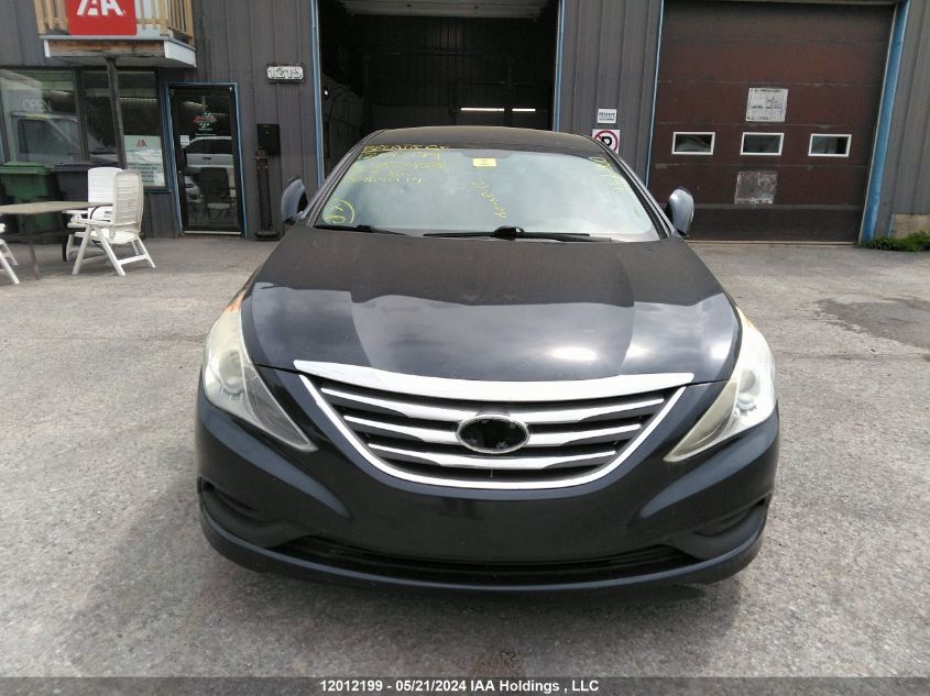 2014 Hyundai Sonata VIN: 5NPEB4AC8EH824581 Lot: 12012199