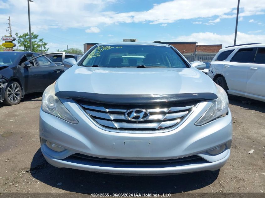 2011 Hyundai Sonata Gls VIN: 5NPEB4AC3BH277764 Lot: 12012555