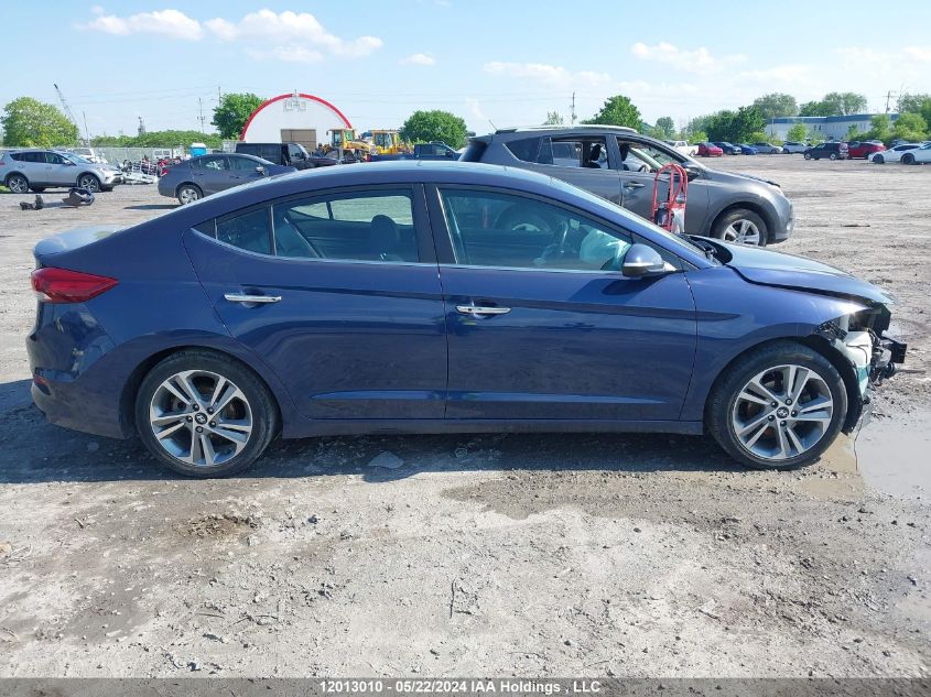 2017 Hyundai Elantra Se/Value/Limited VIN: KMHD84LF9HU255456 Lot: 12013010