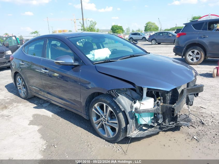 2017 Hyundai Elantra Se/Value/Limited VIN: KMHD84LF9HU255456 Lot: 12013010