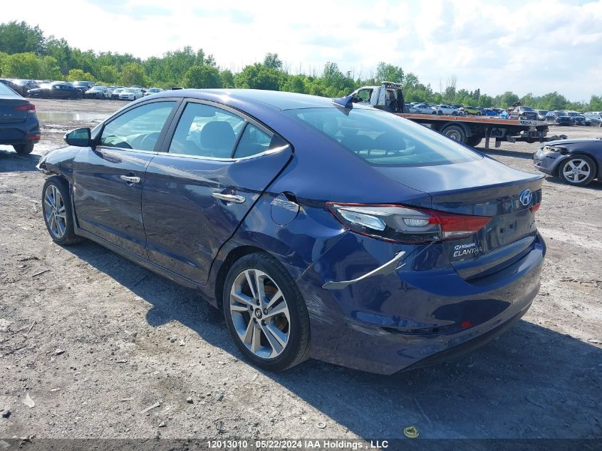 2017 Hyundai Elantra Se/Value/Limited VIN: KMHD84LF9HU255456 Lot: 12013010