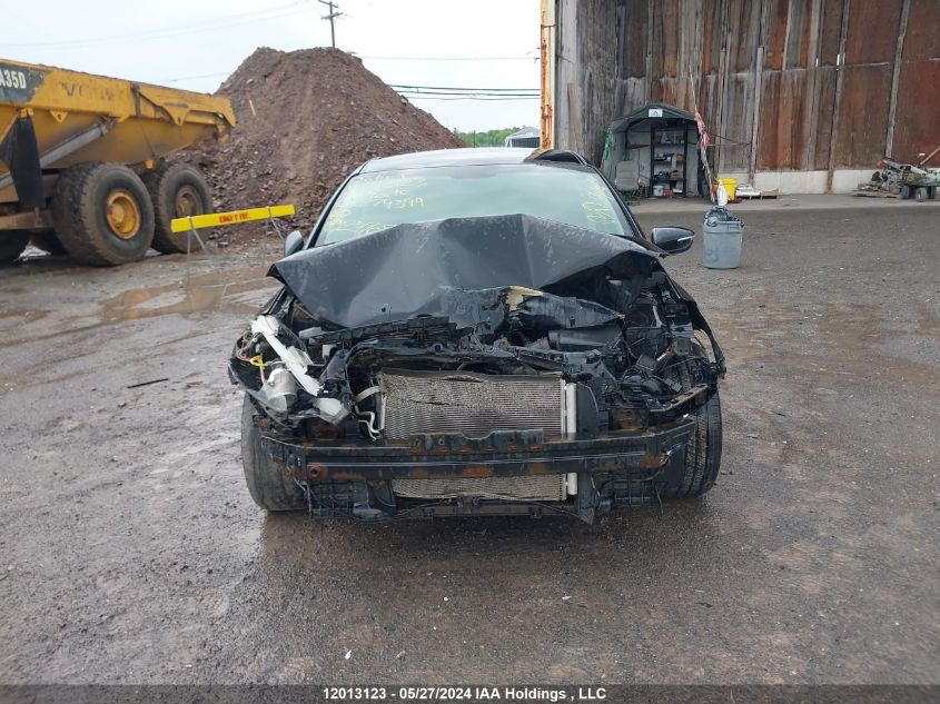 2015 Kia Forte 5-Door VIN: KNAFK5A84F5279399 Lot: 12013123