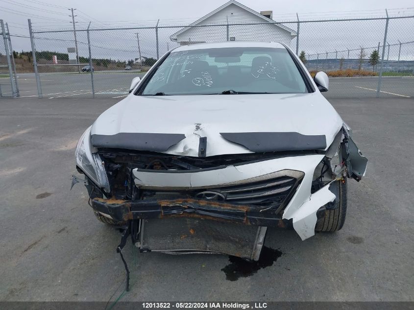 2016 Hyundai Sonata Gls VIN: 5NPE24AF1GH293897 Lot: 12013522