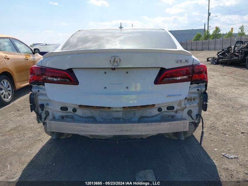 2015 Acura Tlx VIN: 19UUB3F58FA801697 Lot: 12013685