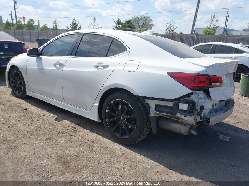 2015 Acura Tlx VIN: 19UUB3F58FA801697 Lot: 12013685