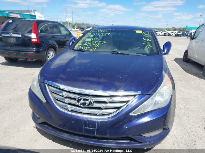 2011 Hyundai Sonata Gls VIN: 5NPEB4AC5BH175527 Lot: 12013884